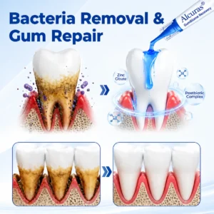 Alcuras® GumBiome Recovery Gel